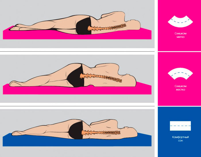 Влияние степени жесткости матраса на поддержку естественных изгибов позвоночника